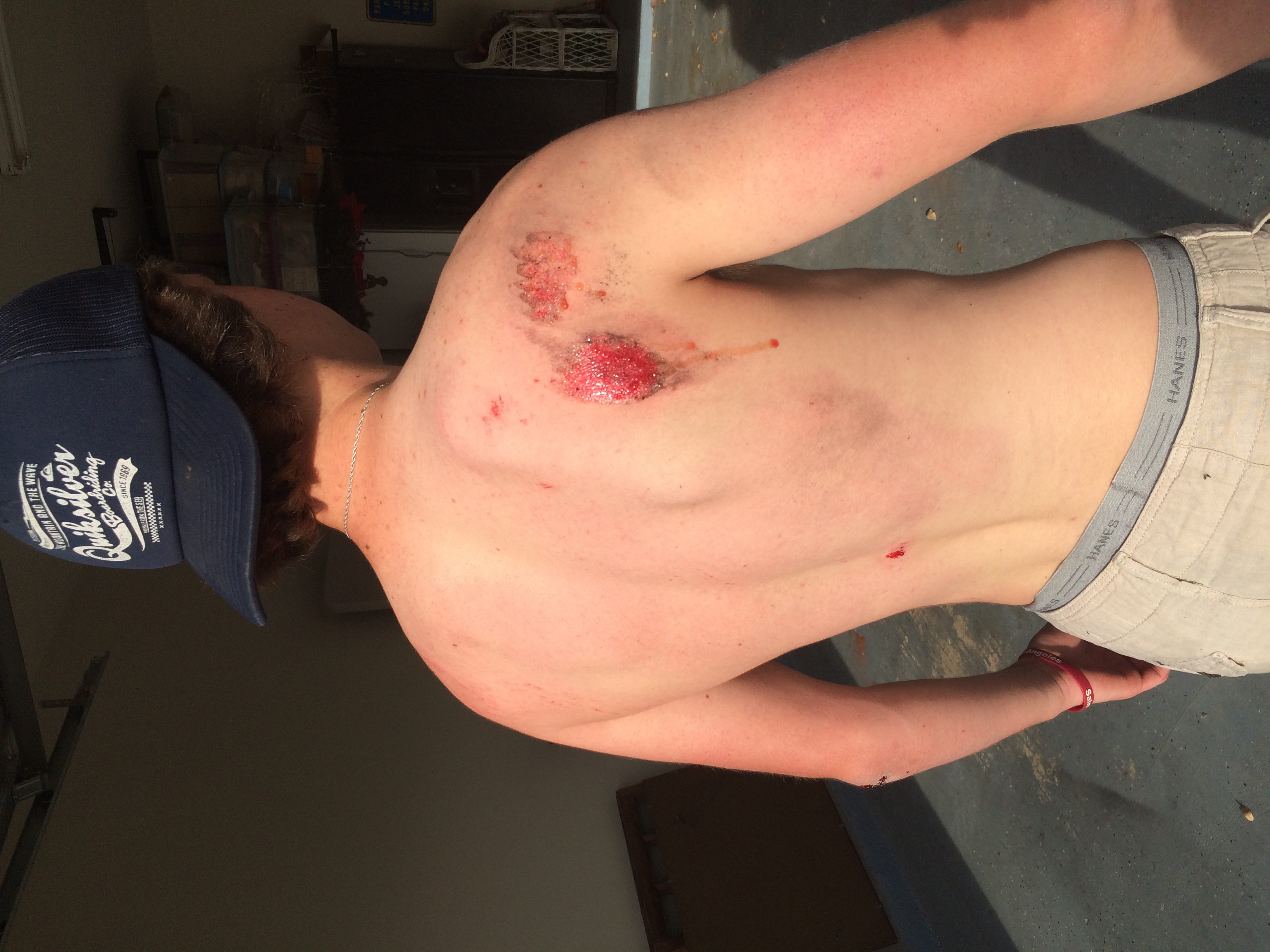 austin oden longboarding accident elevated clothing distressed